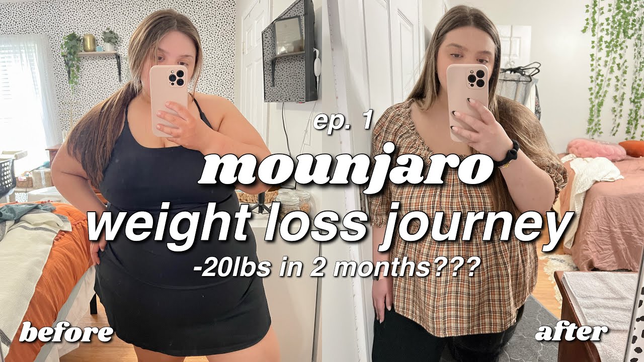 Mounjaro Weight Loss Before and After